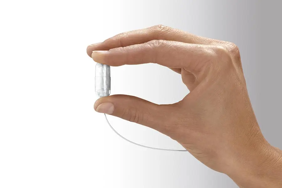 Gastric capsule placement for weight loss without surgery or sedation