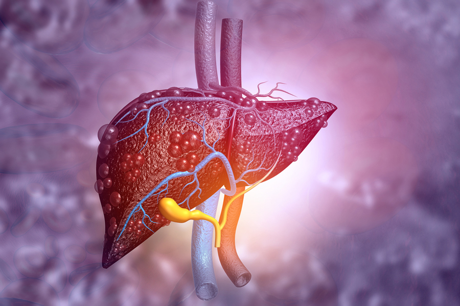 Treatment of liver diseases and cirrhosis